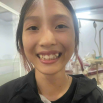 Case niềng răng 