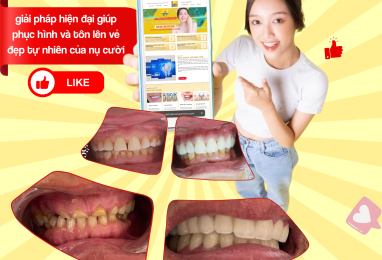 Làm Răng Sứ Uy Tín Tại Gò Xoài | Nha Khoa Hoàng Yến – Nụ Cười Triệu Đô