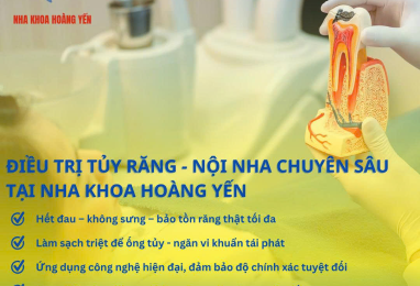 Điều Trị Tủy Răng Chuyên Sâu Tại Nha Khoa Hoàng Yến