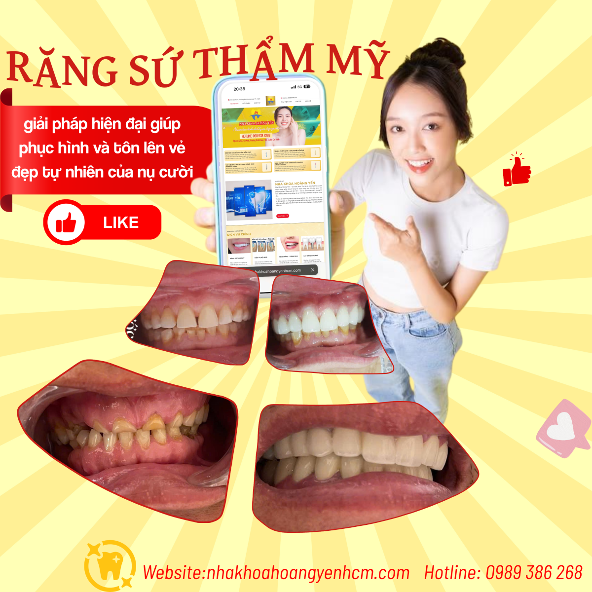 Nha khoa Hoàng Yến - Răng Sứ Thẩm Mỹ