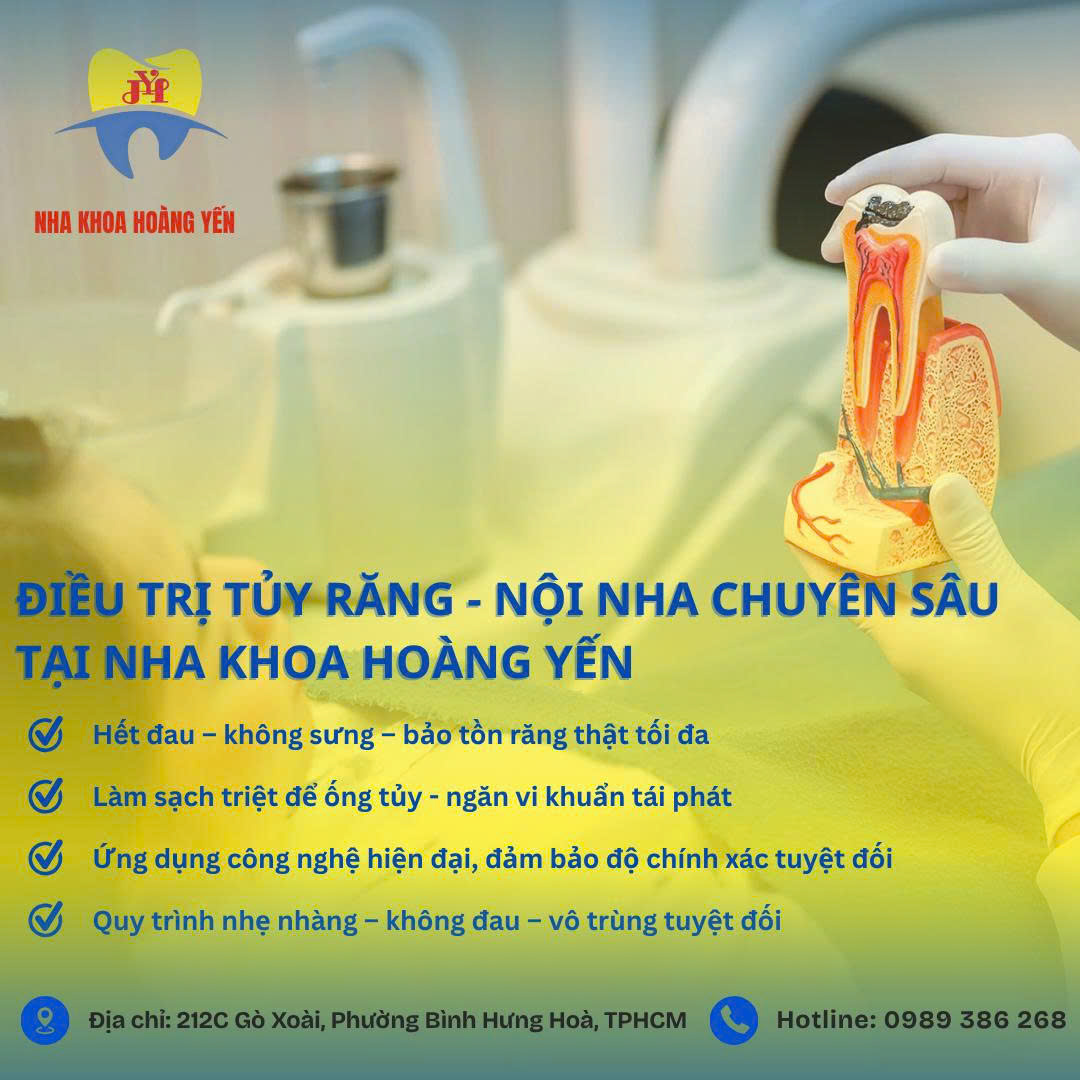 Điều Trị Tủy Răng Chuyên Sâu Tại Nha Khoa Hoàng Yến