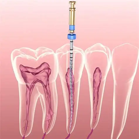 ​ Điều trị nội nha tại Nha Khoa Hoàng Yến